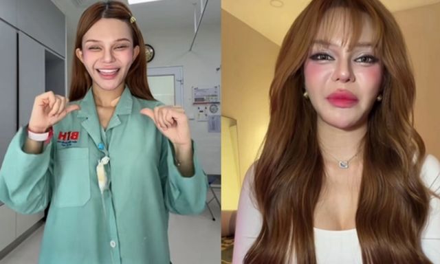 PGĐ Trung tâm Ung bướu: Không có chuyện mắc ung thư máu vì thức khuya và uống trà sữa