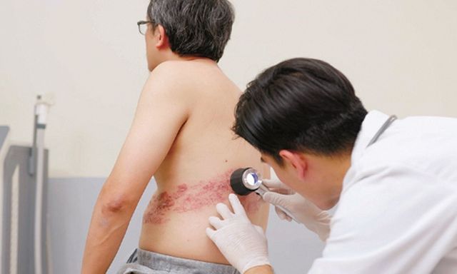 Khảo sát trên 6.000 người lớn tuổi: 78% lo sợ bị căn bệnh quen thuộc này 