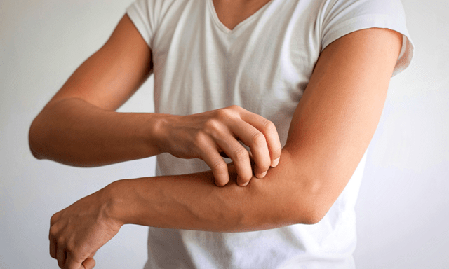 Ngứa kéo dài không rõ nguyên nhân: Bác sĩ BV Bạch Mai cảnh báo “nhiễm độc” từ bên trong, gây suy thận nặng