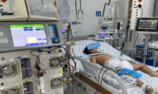 Bé trai 4 tuổi nguy kịch vì uống quá liều paracetamol: Bác sĩ cảnh báo sai lầm nhiều phụ huynh dễ mắc khi con sốt