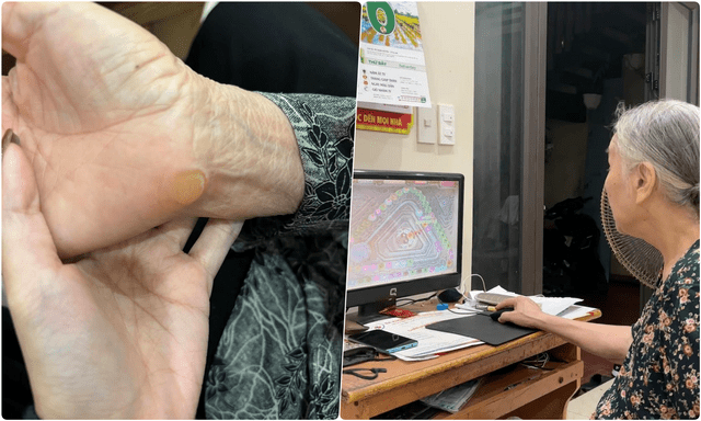 Cụ bà U90 chai cả tay vì 