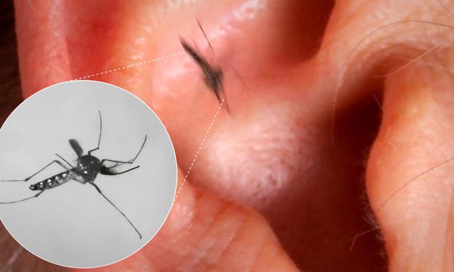 Vì sao muỗi luôn vo ve bên tai con người dù điều đó khiến chúng dễ bị phát hiện và tiêu diệt
