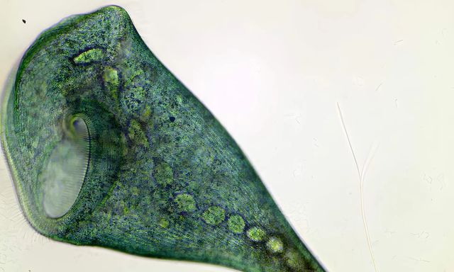 Sinh vật đơn bào Stentor coeruleus chứng minh rằng học hỏi có thể không cần dùng tới não