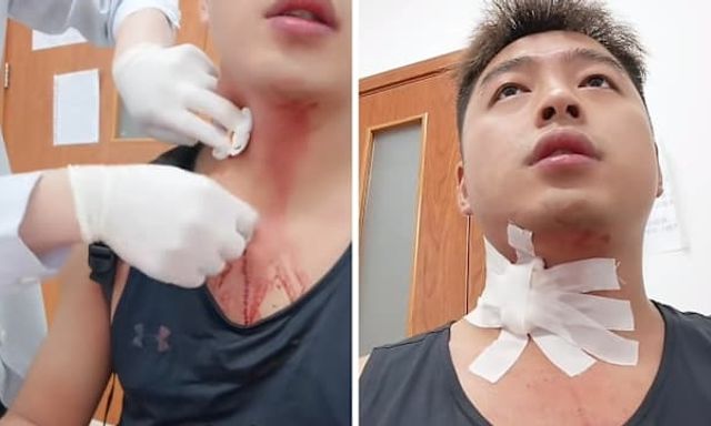 Người đàn ông suýt 