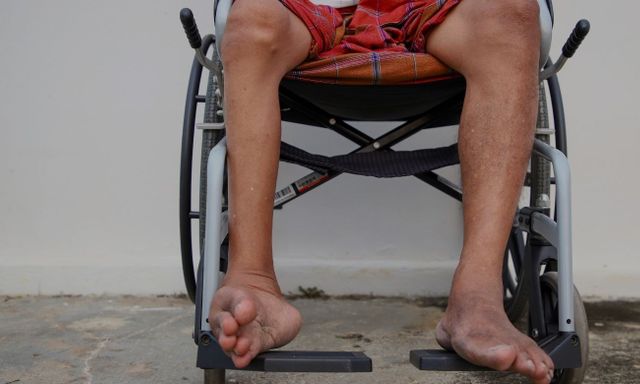 Căn bệnh đã biến mất có nguy cơ quay lại: Bộ Y tế họp toàn quốc