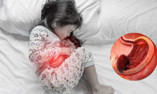 Bé gái 13 tuổi mắc ung thư dạ dày giai đoạn cuối, nguyên nhân đến từ thói quen của bố