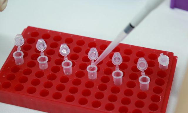 Mang mẫu tóc con trai đi xét nghiệm ADN: Chưa kịp vui đã phải sốc nặng vì điều này