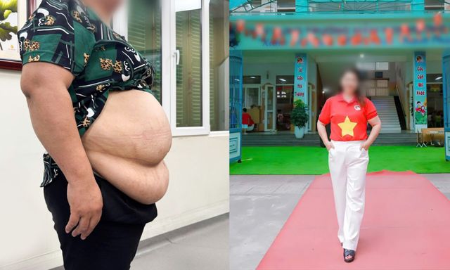 Bị từ chối hút mỡ vì quá béo, cô giáo mầm non 101kg “lột xác” theo cách không ngờ