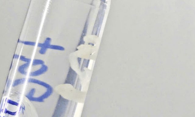 Bác sĩ kéo 
