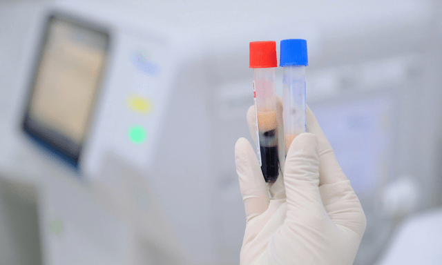 29 tuổi, mỡ máu cao vút dù ăn uống khoa học, cân nặng bình thường: Không ngờ lý do là điều này