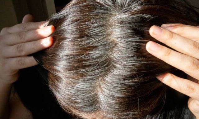 Bạc tóc đang trẻ hóa ở người Việt, có bé 6 tuổi tóc đã bạc trắng: Bác sĩ giải mã bí ẩn phía sau