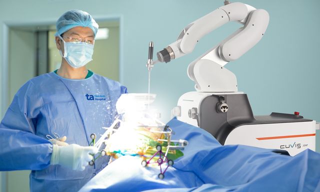 Việt Nam lần đầu có robot AI “tự mổ”: Chính xác đến từng milimet, thế giới mới có 9 nước sở hữu