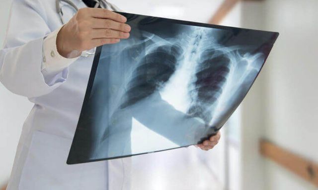 Chụp chiếu khắp nơi không ra bệnh, nam thanh niên 27 tuổi nhập viện tâm thần vì lý do bất ngờ