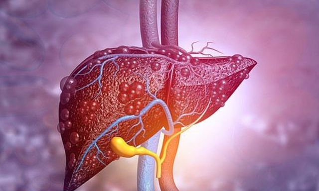 Lá gan xơ xác, suy hỏng chỉ vì 1 thói quen: Nhiều người Việt tưởng tốt, làm mỗi ngày