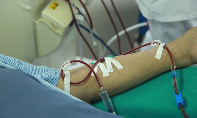 Có dấu hiệu này cần nghĩ tới suy thận - bác sĩ cảnh báo