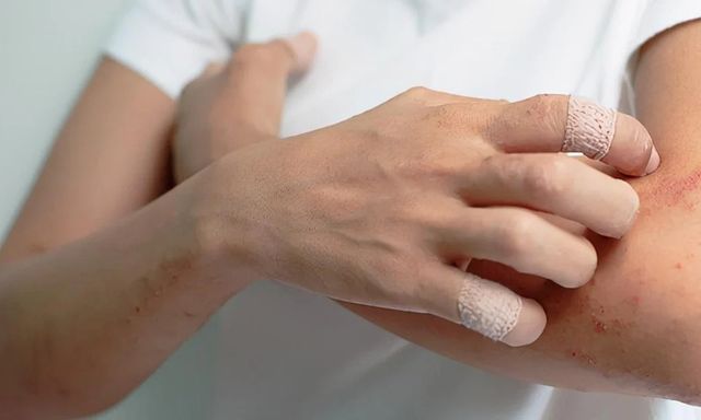 Thức khuya, ăn đồ ăn giao tận nhà suốt nhiều năm, người phụ nữ ân hận nhận 