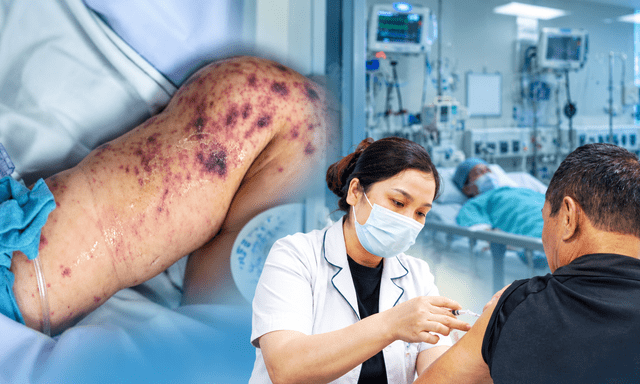 Căn bệnh truyền nhiễm diễn biến tối cấp, đe dọa tính mạng chỉ trong vài giờ: Ghi nhận ổ dịch tại TP.HCM