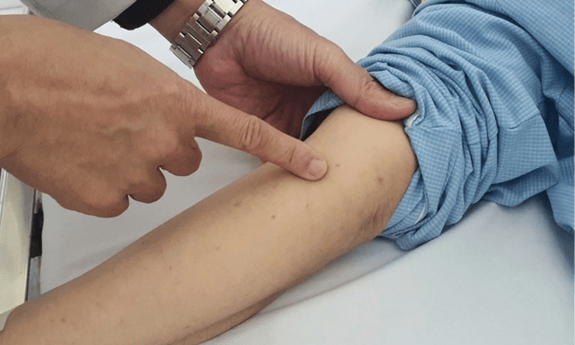 Gần 40.000 mũi vaccine não mô cầu được tiêm trên toàn quốc trong 4 ngày