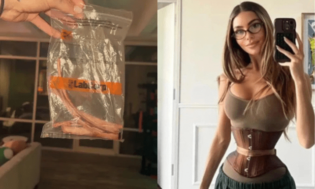 Cô gái 28 tuổi chi 362 triệu, cắt 6 xương sườn để có vòng eo con kiến - trào lưu thẩm mỹ kinh hoàng quay trở lại