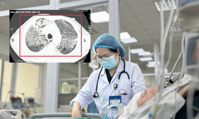 Mang theo “vi khuẩn tử thần” về từ Thái Lan, người đàn ông 35 tuổi nhập viện trong tình trạng cận kề tử vong