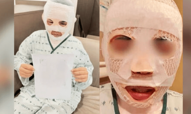 Vợ đang ngủ bị chồng tạt nước sôi vào mặt để huỷ dung vì sợ 