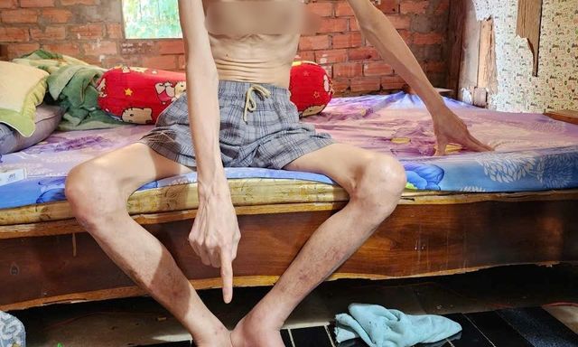 Bắt giữ Hoàng Thanh Hùng, thu giữ 36 ống hút nhựa 