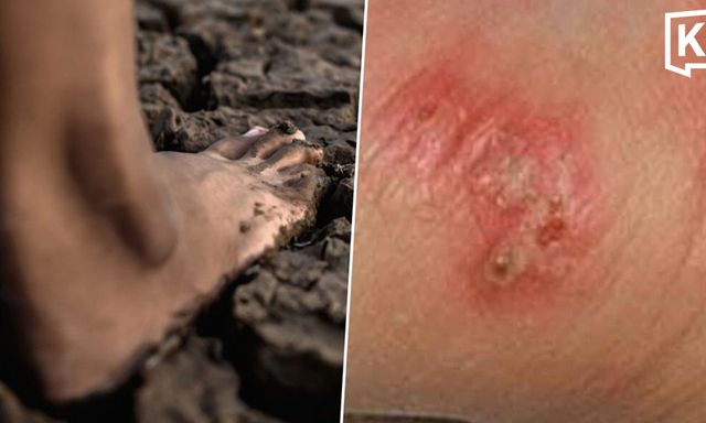 Thái Lan cảnh báo khẩn về dịch 