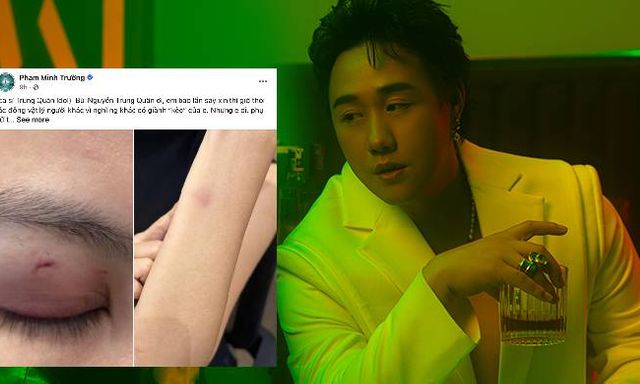 Nóng: Công an vào cuộc vụ ca sĩ Trung Quân Idol bị tố hành hung phụ nữ ở TPHCM