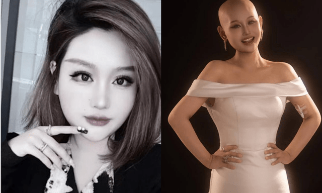 Cô gái từng tổ chức đám cưới với chính mình qua đời ở tuổi 29: Chia sẻ cuối cùng gây xúc động mạnh