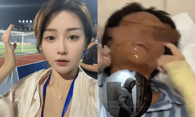 Nữ streamer xinh đẹp bị “hủy dung” sau khi mở gói hàng, danh tính shipper được tiết lộ khiến cô hoảng sợ