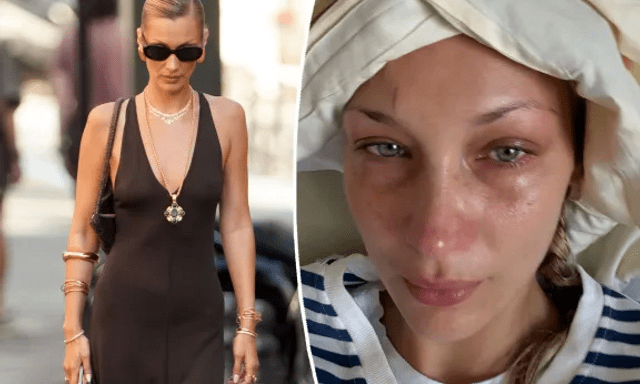 Bella Hadid đau đớn, tàn tạ không nhận ra khi bệnh nặng tái phát 