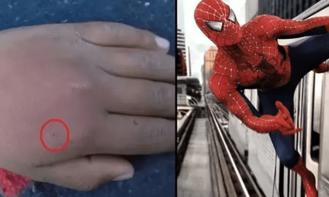 Cho nhện cắn với mong ước trở thành Spider-Man, nam game thủ nhập viện khẩn cấp