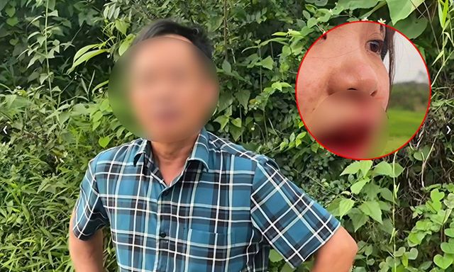 Vụ cô gái tố tài xế ô tô hành hung chảy máu mồm: Người đánh là cán bộ xã