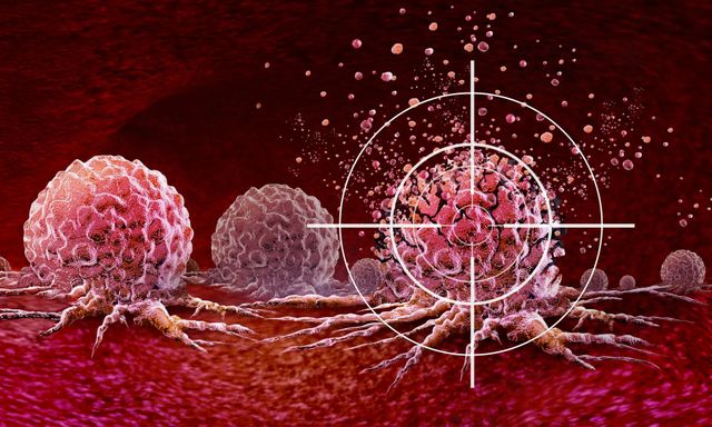 Ung thư rất ‘thích’ 2 loại thực phẩm này, chuyên gia cảnh báo: 