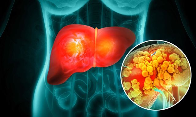 Không phải thịt mỡ, đây mới là 