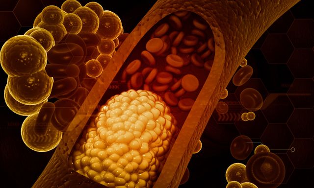 Ăn nhiều rau luộc, ít thịt cả 3 bữa trong ngày nhưng mỡ máu vẫn cao vút: Bất ngờ với 