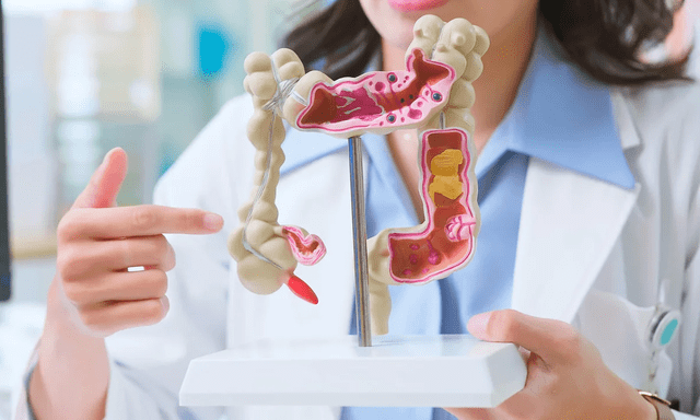 Ung thư đại trực tràng gia tăng ở người trẻ: Đây là 11 cách phòng ngừa, bạn làm được mấy?