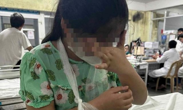 Cô giáo dùng thước gỗ đánh gãy tay học sinh lớp 4: Gia đình tiết lộ nguyên nhân