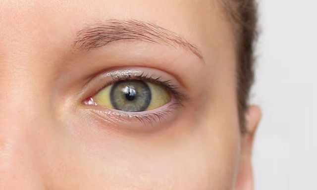 Cảnh báo 4 dấu hiệu của loại ung thư 