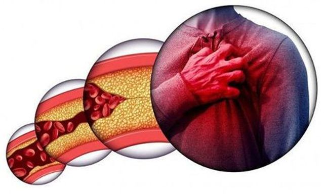 Gầy nhưng mỡ máu vẫn cao vút: Không hề vô lý, 