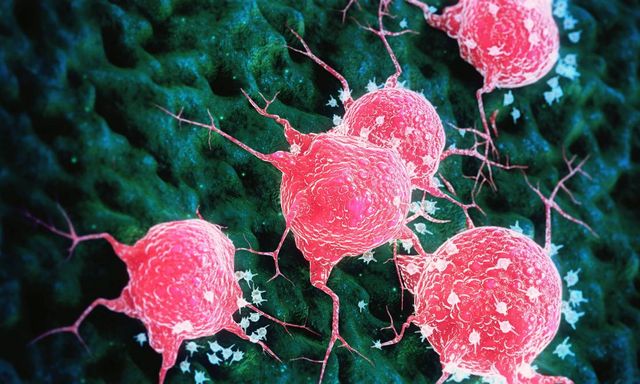 Tác nhân “châm ngòi” cho hàng nghìn ca ung thư nhưng ít ai để ý