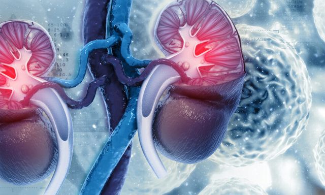 Thận xuống cấp nhanh chóng nếu ăn quá nhiều 9 loại thực phẩm này: Toàn món khoái khẩu của nhiều người