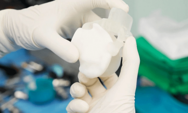 Lần đầu tại Việt Nam: Thay khớp gối bằng robot AI 