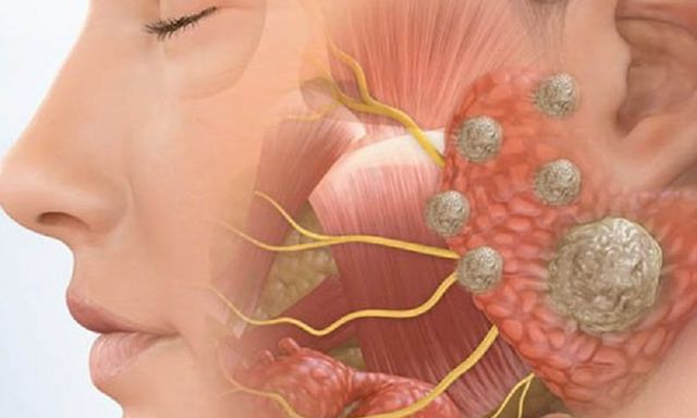 Có 1 dấu hiệu bất thường ở mặt, đi khám phát hiện hàng loạt vấn đề ở phổi, gan, thận, dạ dày