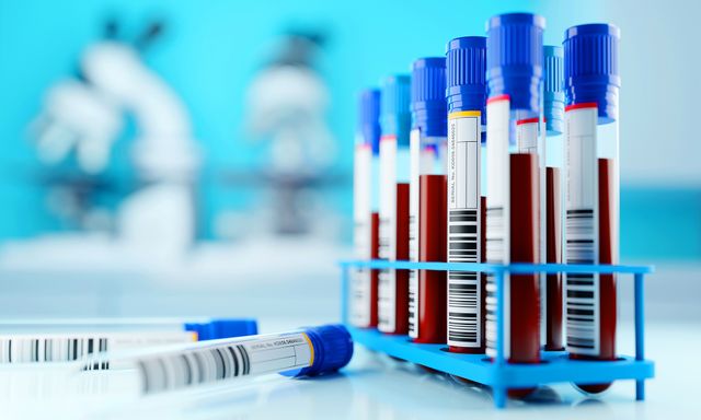 5 xét nghiệm nên làm khi bước sang tuổi 35