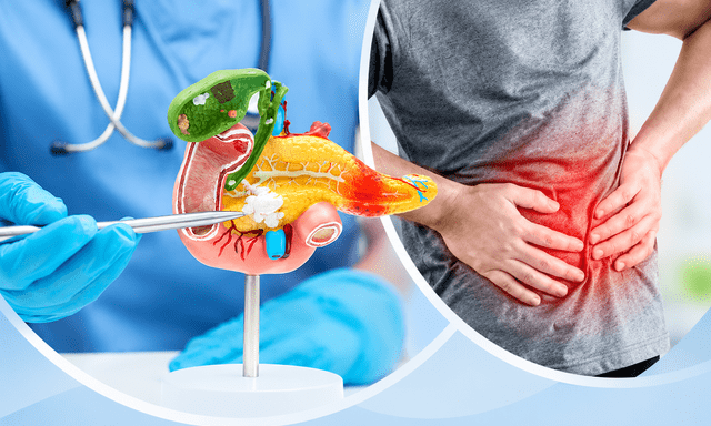 Khám cho nhiều người mắc ung thư tuyến tụy giai đoạn cuối, bác sĩ tiếc nuối: Dấu hiệu xuất hiện sớm nhưng hay bị bỏ qua
