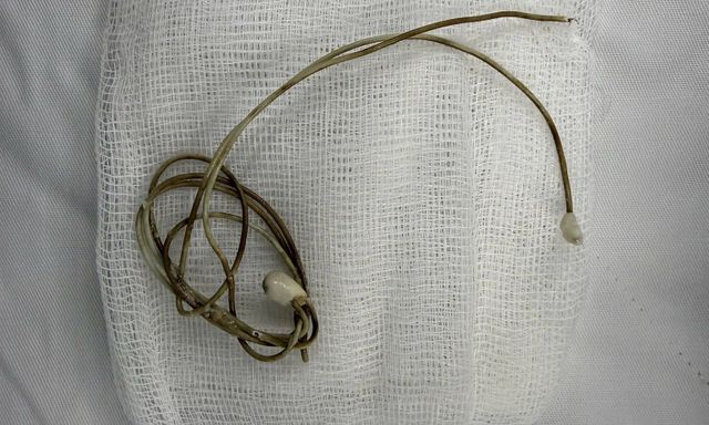 Dây sạc điện thoại nằm trong bàng quang của nam sinh sau khi học theo clip trên mạng