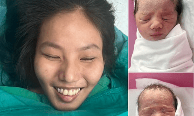 Mẹ bầu nuôi tạm bàn tay ở cẳng chân đã sinh con an toàn