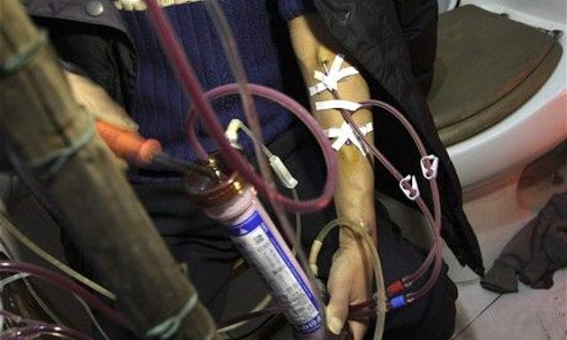 Nam kỹ sư 26 tuổi đột ngột phát hiện suy thận giai đoạn 4 kể: 