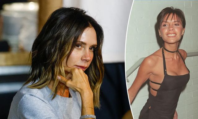  Victoria Beckham đã phải chịu đựng căn bệnh này suốt 25 năm qua